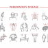 What is the Difference between the Essential tremors and Parkinson’s Tremors?